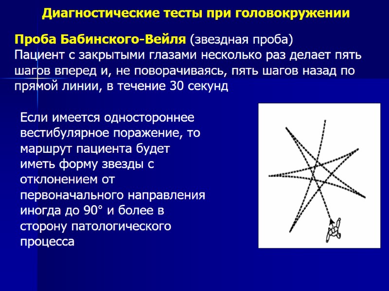 Диагностические тесты при головокружении Проба Бабинского-Вейля (звездная проба) Пациент с закрытыми глазами несколько раз